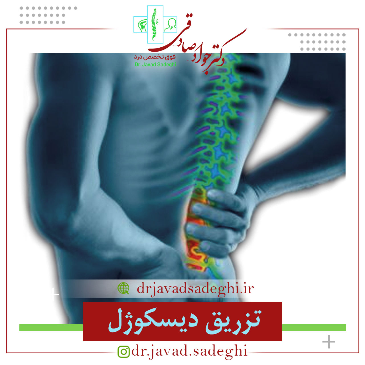 تزریق دیسکوژل
