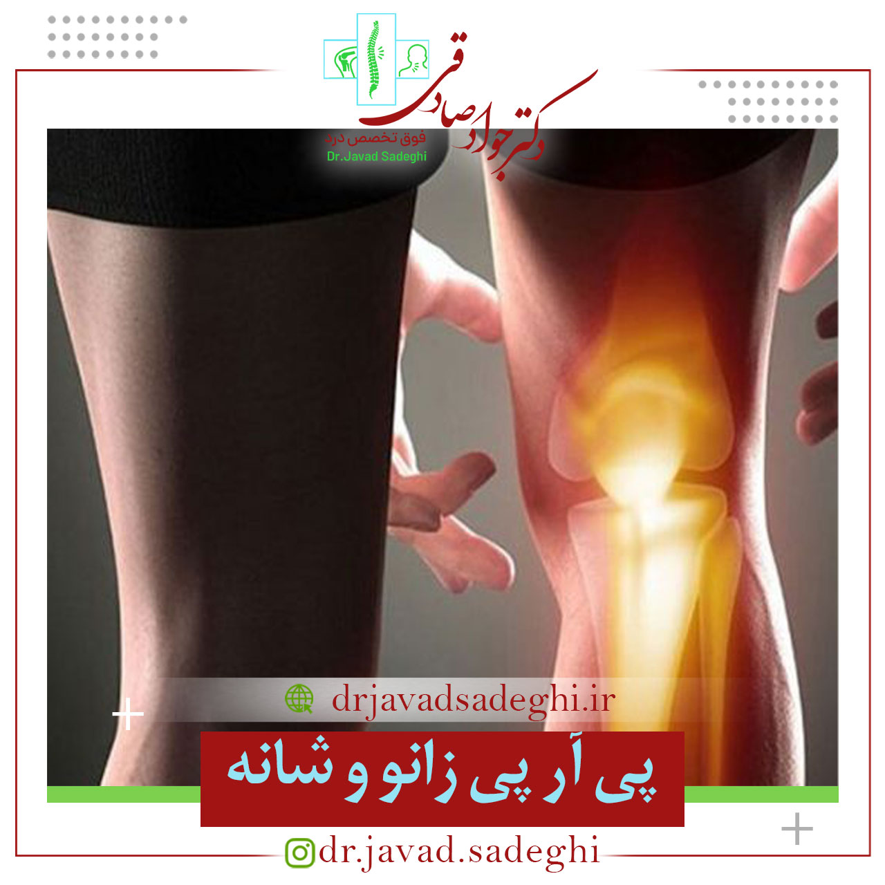 پی آر پی زانو و شانه