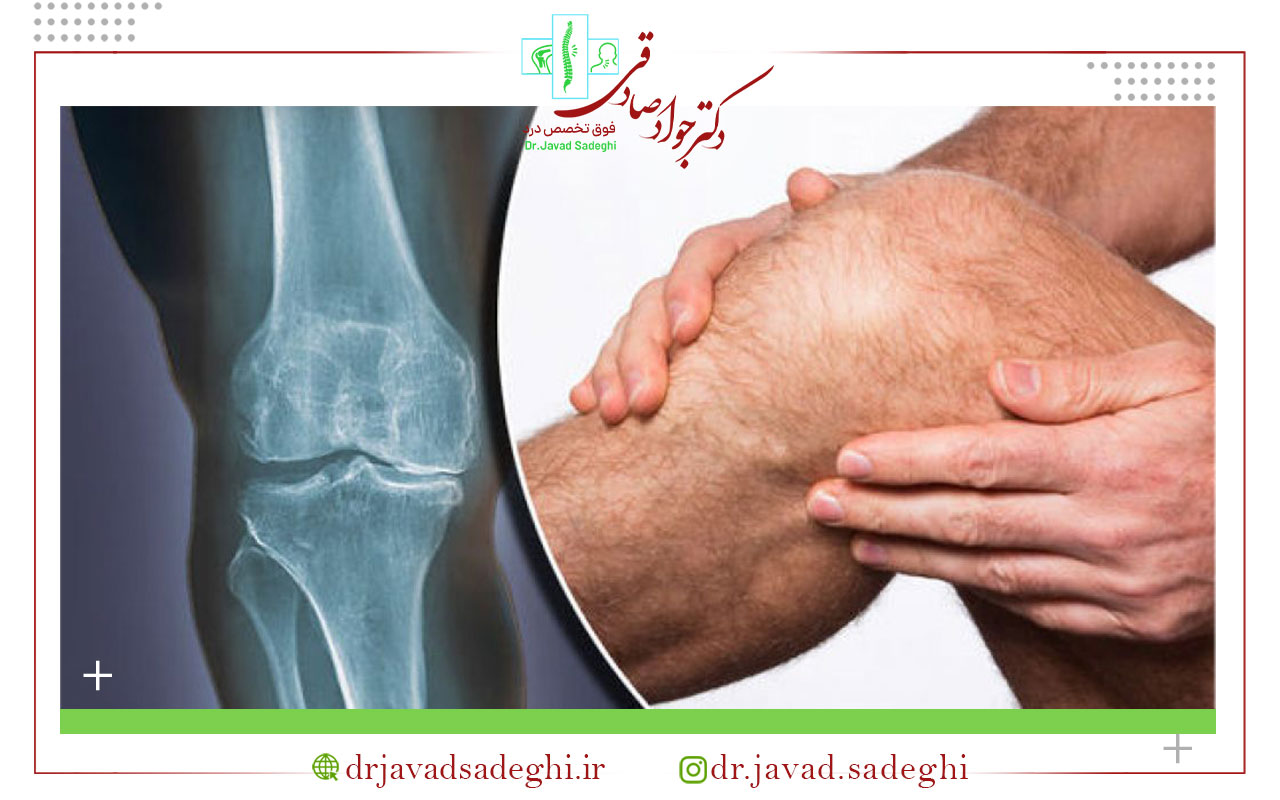 استراحت بعد پس از تزریق پی آر پی؟
