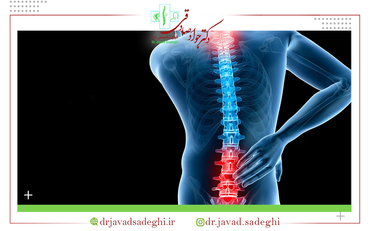 فتق دیسک چیست؟
