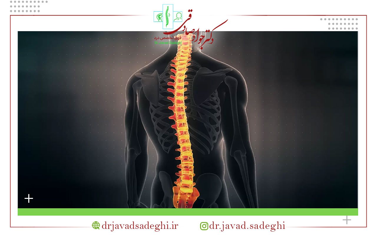 انواع عمل بسته دیسک کمر