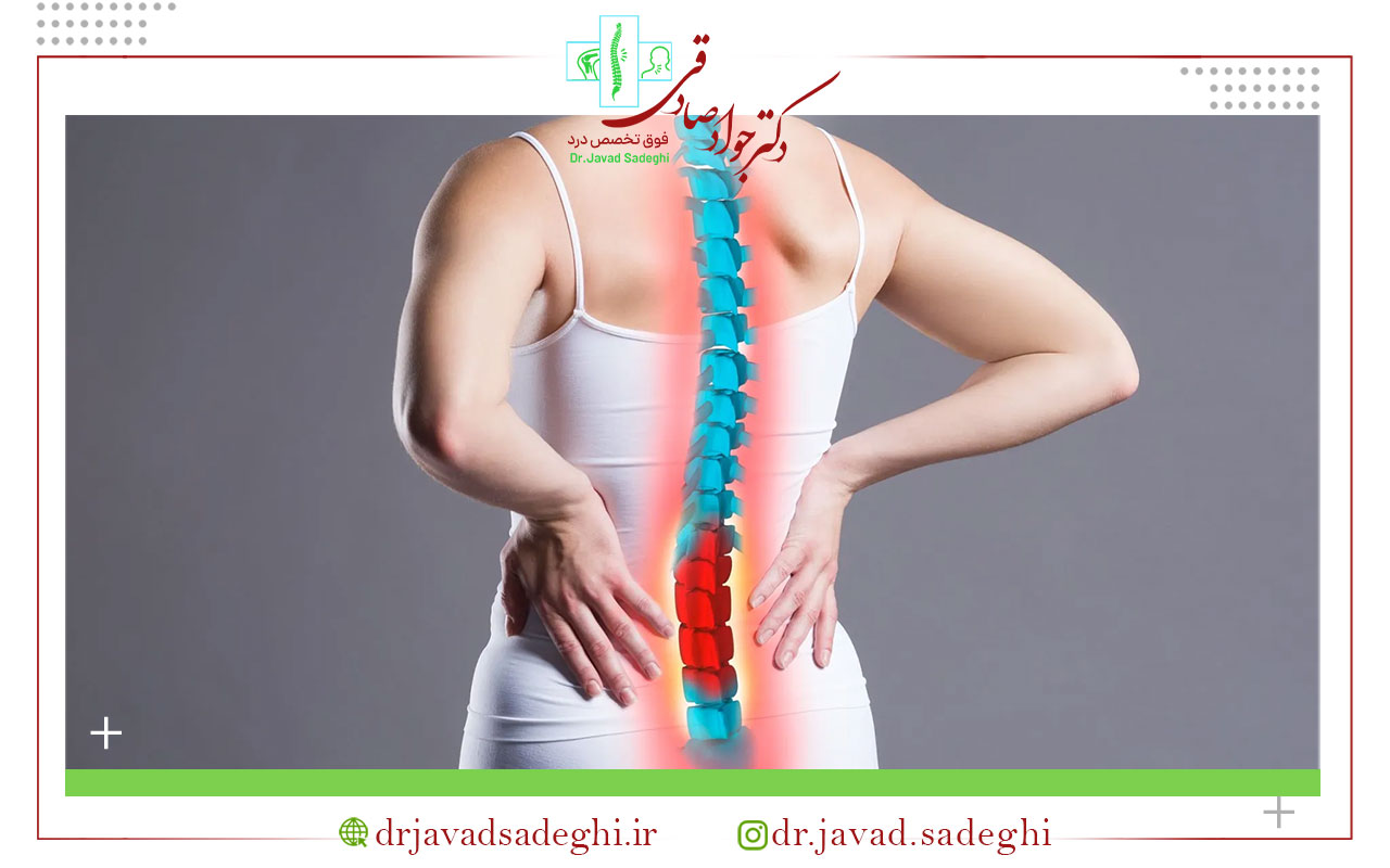 درمان اسپوندیلوز کمری