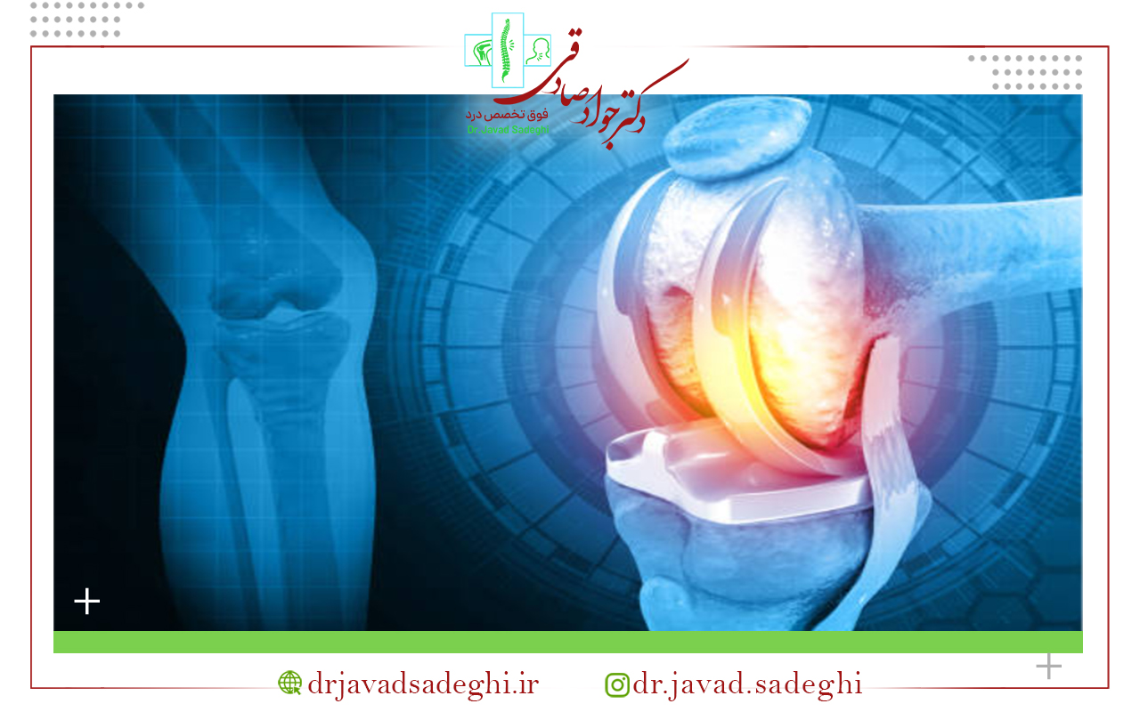 عوارض و مشکلات تعویض مفصل زانو چیست؟
