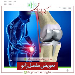 تعویض مفصل زانو